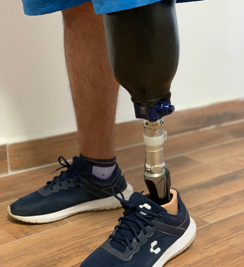 Protesis de pierna