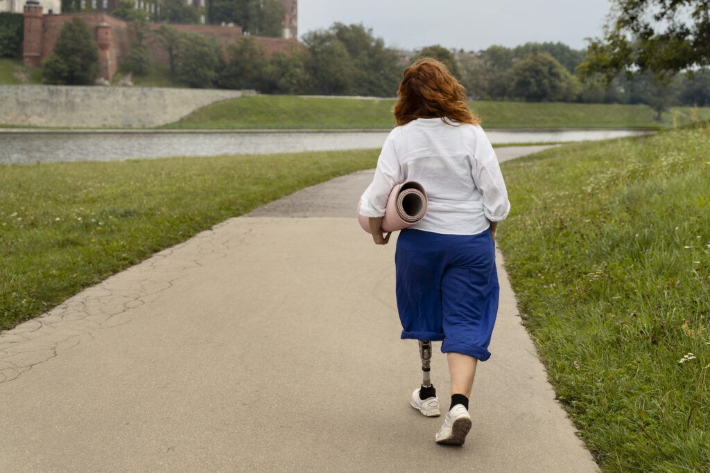 Molestias por una prótesis de pierna