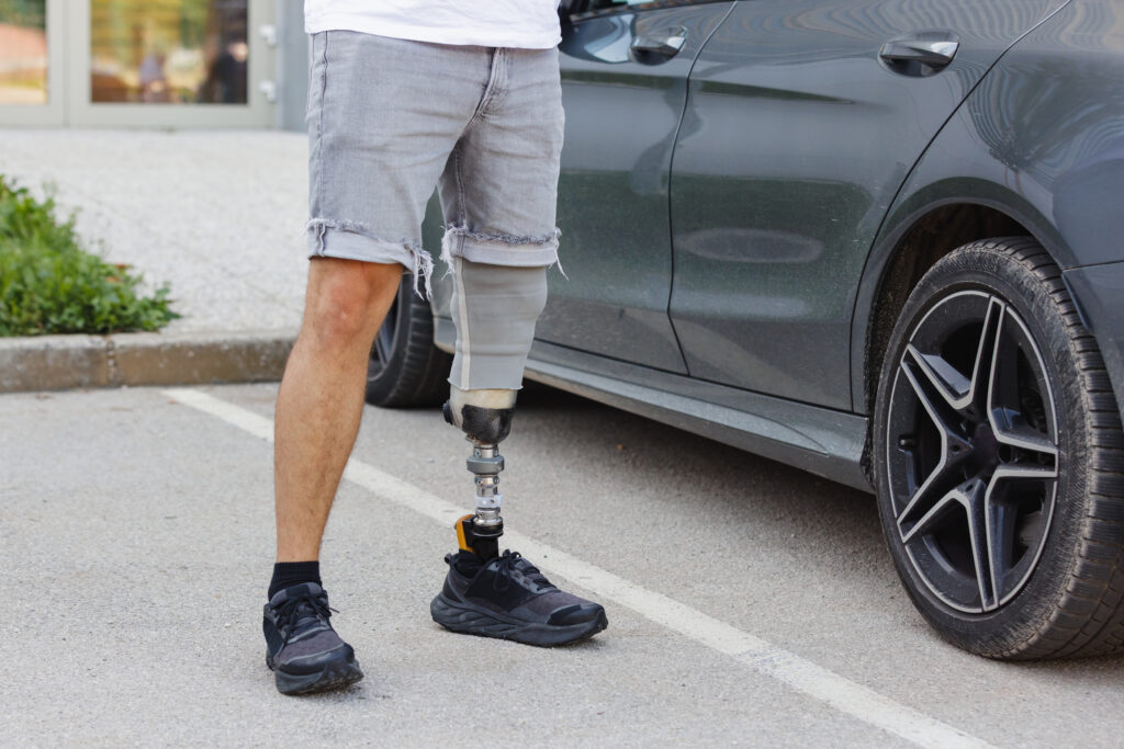 Ajuste correcto de prótesis de pierna