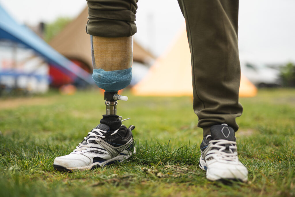 Prótesis biónicas de pierna