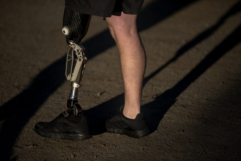 Prótesis mioeléctricas de pierna