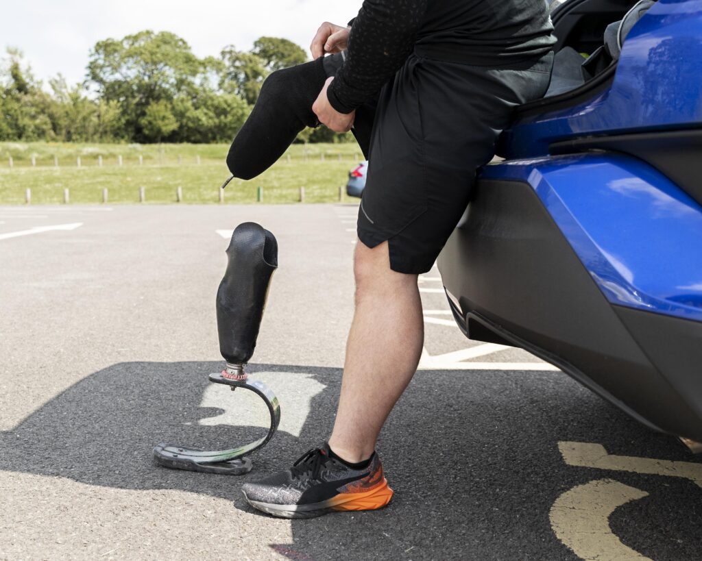 mala adaptación de prótesis de pierna