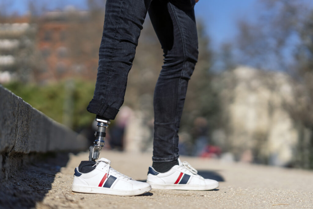 equilibrio con prótesis de pierna
